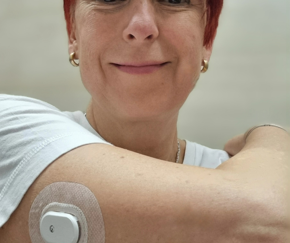 CGM folyamatos glükózmonitorozás
